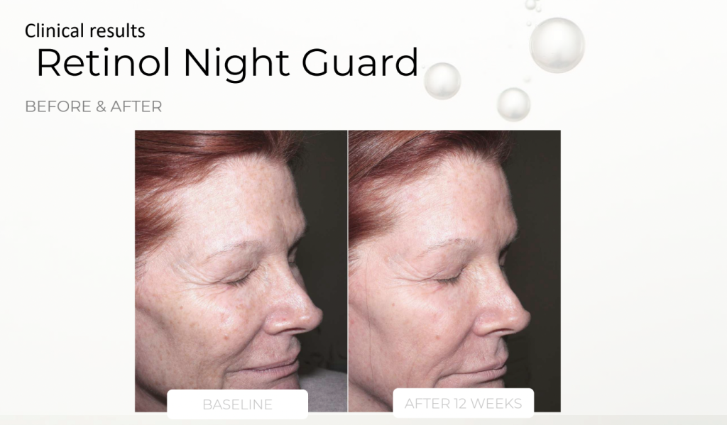 Retinol Night Guard – product details, medical-grade skincare by Zahav Medspa